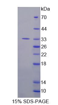 双丝氨酸/苏氨酸酪氨酸蛋白激酶(DSTYK)重组蛋白,Recombinant Dual Serine/Threonine And Tyrosine Protein Kinase (DSTYK)