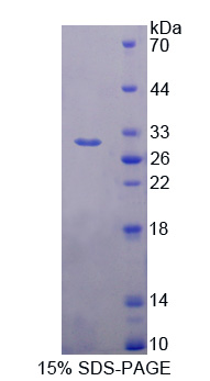 雙腎上腺皮質(zhì)激素樣激酶1(DCLK1)重組蛋白,Recombinant Doublecortin Like Kinase 1 (DCLK1)