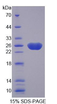 衰老关键蛋白3(FBLN3)重组蛋白,Recombinant Fibulin 3 (FBLN3)