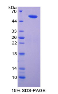 輸入蛋白8(IPO8)重組蛋白,Recombinant Importin 8 (IPO8)