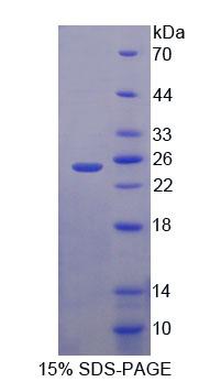 輸出蛋白5(XPO5)重組蛋白,Recombinant Exportin 5 (XPO5)