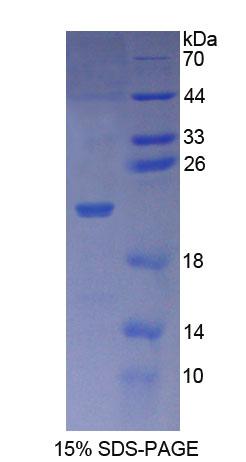 输出蛋白1(XPO1)重组蛋白,Recombinant Exportin 1 (XPO1)