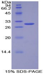 瘦素受体(LEPR)重组蛋白,Recombinant Leptin Receptor (LEPR)