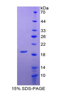 瘦素(LEP)重组蛋白,Recombinant Leptin (LEP)