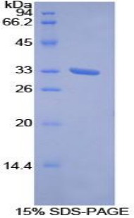 受体酪氨酸激酶样孤儿素受体1(ROR1)重组蛋白,Recombinant Receptor Tyrosine Kinase Like Orphan Receptor 1 (ROR1)