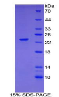 嗜中性粒细胞胞浆因子2(NCF2)重组蛋白,Recombinant Neutrophil Cytosolic Factor 2 (NCF2)