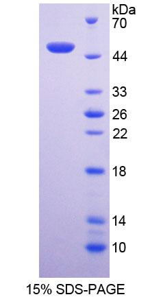 嗜中性粒细胞胞浆因子1(NCF1)重组蛋白,Recombinant Neutrophil Cytosolic Factor 1 (NCF1)