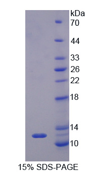 嗜酸粒细胞趋化因子(ECF)重组蛋白,Recombinant Eosinophil Chemotactic Factor (ECF)