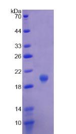 嗜铬蛋白A(CHGA)重组蛋白,Recombinant Chromogranin A (CHGA)