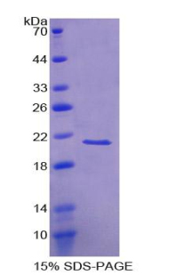 視錐蛋白樣蛋白1(VSNL1)重組蛋白,Recombinant Visinin Like Protein 1 (VSNL1)