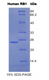 视网膜母细胞瘤蛋白1(RB1)重组蛋白,Recombinant Retinoblastoma Protein 1 (RB1)