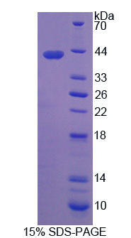 視黃醛結(jié)合蛋白1(RLBP1)重組蛋白,Recombinant Retinaldehyde Binding Protein 1 (RLBP1)