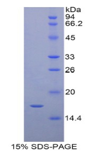 视黄醇结合蛋白7(RBP7)重组蛋白,Recombinant Retinol Binding Protein 7, Cellular (RBP7)