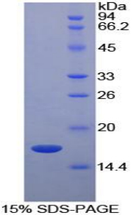视黄醇结合蛋白5(RBP5)重组蛋白,Recombinant Retinol Binding Protein 5, Cellular (RBP5)
