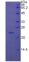 視黃醇結合蛋白4(RBP4)重組蛋白,Recombinant Retinol Binding Protein 4 (RBP4)