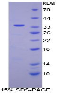 視黃醇結(jié)合蛋白3(RBP3)重組蛋白,Recombinant Retinol Binding Protein 3, Interstitial (RBP3)