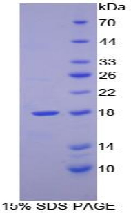 視黃醇結(jié)合蛋白2(RBP2)重組蛋白,Recombinant Retinol Binding Protein 2, Cellular (RBP2)