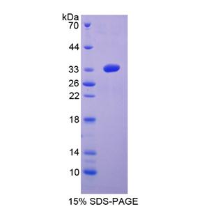 絲裂原激活蛋白激酶激酶6(MAP2K6)重組蛋白,Recombinant Mitogen Activated Protein Kinase Kinase 6 (MAP2K6)