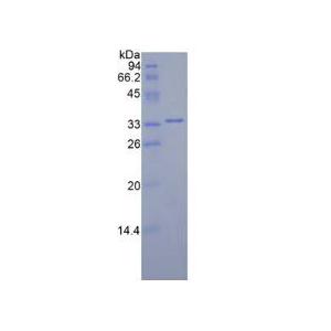 丝裂原激活蛋白激酶激酶2(MAP2K2)重组蛋白