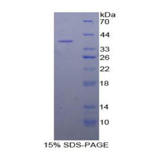 丝裂原激活蛋白激酶激酶1(MAP2K1)重组蛋白