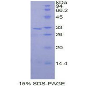 丝裂原激活蛋白激酶9(MAPK9)重组蛋白,Recombinant Mitogen Activated Protein Kinase 9 (MAPK9)