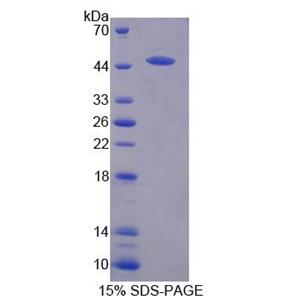 丝裂原激活蛋白激酶13(MAPK13)重组蛋白,Recombinant Mitogen Activated Protein Kinase 13 (MAPK13)