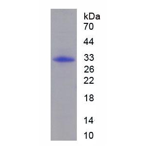 丝裂原激活蛋白激酶12(MAPK12)重组蛋白