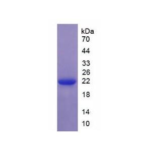 丝甘蛋白聚糖(SRGN)重组蛋白,Recombinant Serglycin (SRGN)