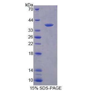 丝氨酸棕榈酰转移酶长链碱性亚基3(SPTLC3)重组蛋白