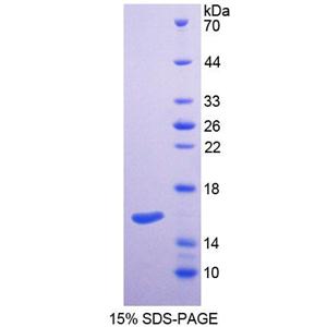 丝氨酸棕榈酰转移酶长链碱性亚基2(SPTLC2)重组蛋白