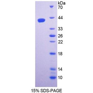 丝氨酸棕榈酰转移酶长链碱性亚基1(SPTLC1)重组蛋白