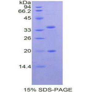 丝氨酸肽酶抑制因子Kazal型5(SPINK5)重组蛋白