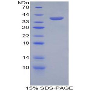 丝氨酸肽酶抑制因子Kazal型1(SPINK1)重组蛋白