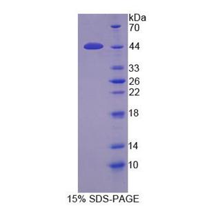 丝氨酸蛋白酶23(PRSS23)重组蛋白,Recombinant Protease, Serine 23 (PRSS23)