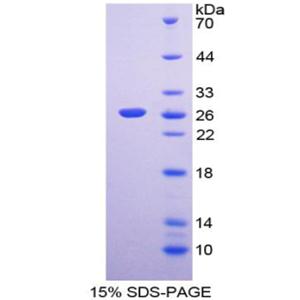 丝氨酸蛋白酶2(PRSS2)重组蛋白,Recombinant Protease, Serine 2 (PRSS2)