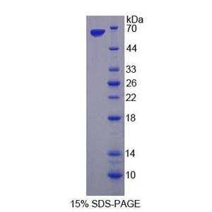 丝氨酸/苏氨酸激酶39(STK39)重组蛋白