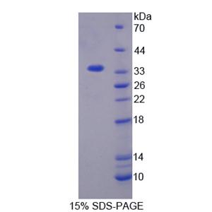 丝氨酸/苏氨酸激酶3(STK3)重组蛋白