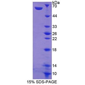 双特异性磷酸酶9(DUSP9)重组蛋白