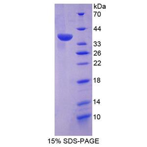 双特异性磷酸酶6(DUSP6)重组蛋白,Recombinant Dual Specificity Phosphatase 6 (DUSP6)