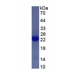 双特异性磷酸酶3(DUSP3)重组蛋白