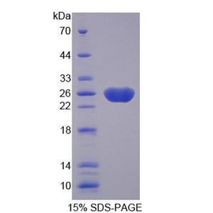 衰老关键蛋白3(FBLN3)重组蛋白,Recombinant Fibulin 3 (FBLN3)