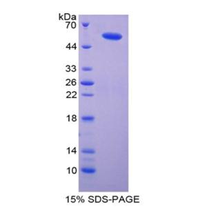 输入蛋白8(IPO8)重组蛋白