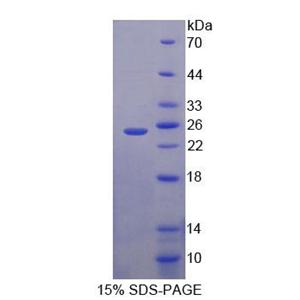 輸出蛋白5(XPO5)重組蛋白,Recombinant Exportin 5 (XPO5)