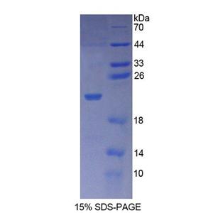 输出蛋白1(XPO1)重组蛋白,Recombinant Exportin 1 (XPO1)