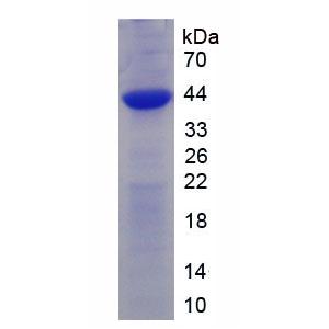 受体活性修饰蛋白2(RAMP2)重组蛋白,Recombinant Receptor Activity Modifying Protein 2 (RAMP2)