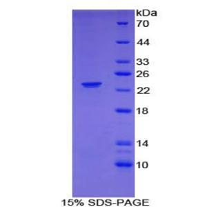 嗜中性粒细胞胞浆因子2(NCF2)重组蛋白,Recombinant Neutrophil Cytosolic Factor 2 (NCF2)