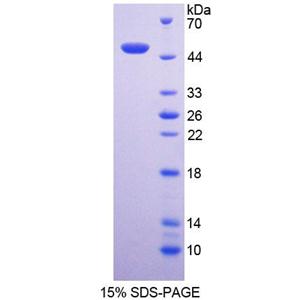 嗜中性粒细胞胞浆因子1(NCF1)重组蛋白,Recombinant Neutrophil Cytosolic Factor 1 (NCF1)