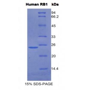 视网膜母细胞瘤蛋白1(RB1)重组蛋白