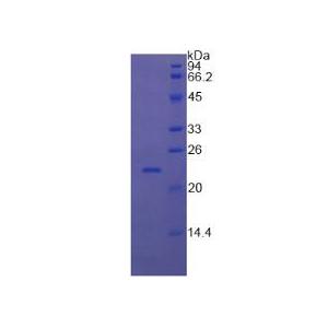 视黄醇结合蛋白4(RBP4)重组蛋白