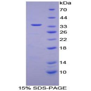 视黄醇结合蛋白3(RBP3)重组蛋白,Recombinant Retinol Binding Protein 3, Interstitial (RBP3)